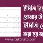 ইসিজি রিপোর্ট বোঝার উপায়